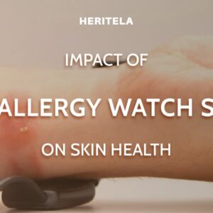 How anti-allergy watch straps can improve your skin health?
